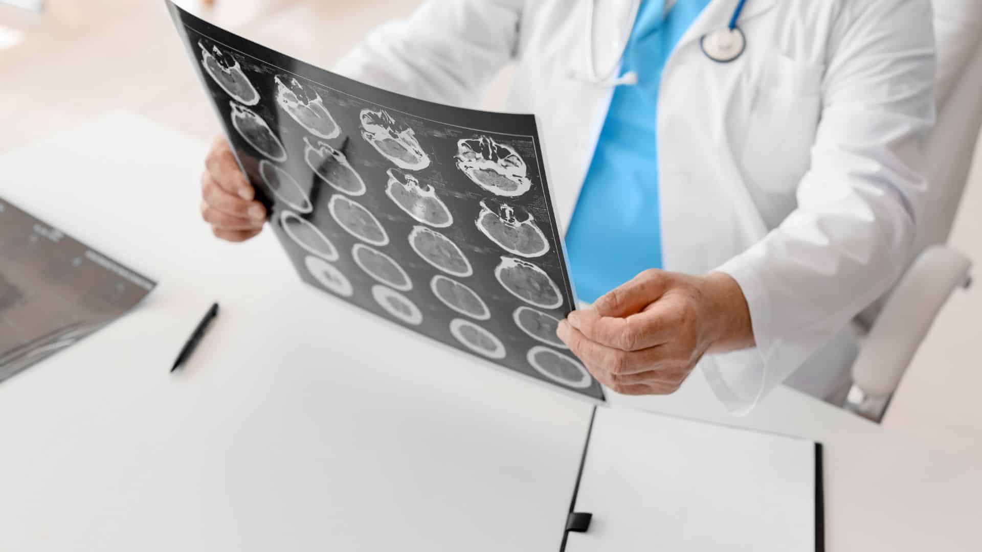 רשלנות רפואית בבדיקת הדמיה